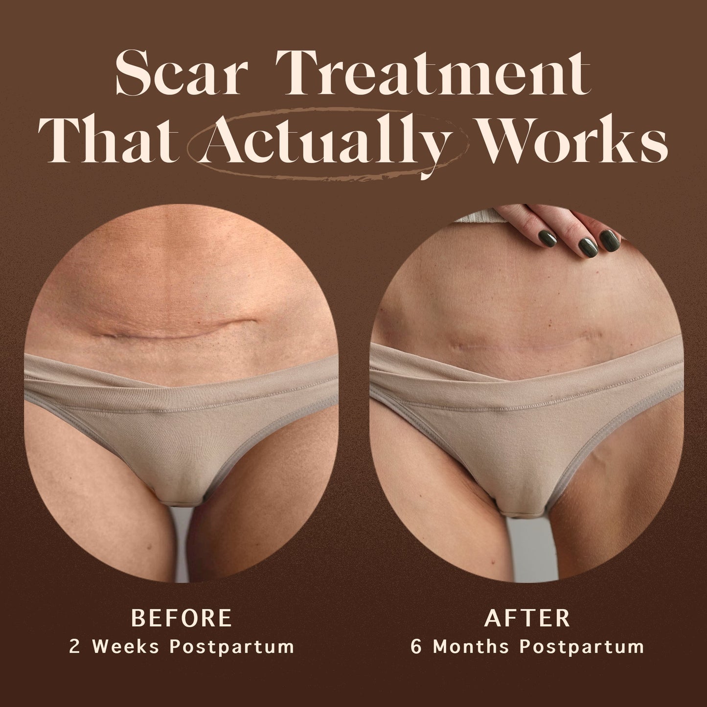 Restorative Scar Treatment by Nēmah